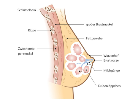 Brustkrebs-Schema